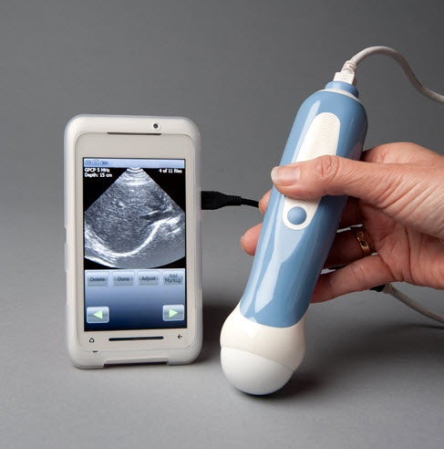 The Ultrasound Attachment